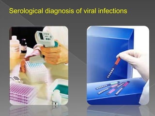 Serological diagnosis of viral infections

 