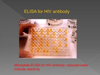 Microplate ELISA for HIV antibody: coloured wells
indicate reactivity

 