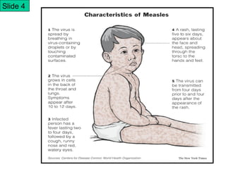 Measles Introduction Virus measles | PPT