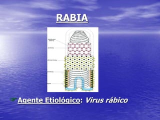 RABIA
Agente Etiológico: Virus rábico
 