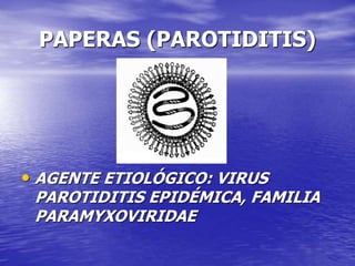 PAPERAS (PAROTIDITIS)
• AGENTE ETIOLÓGICO: VIRUS
PAROTIDITIS EPIDÉMICA, FAMILIA
PARAMYXOVIRIDAE
 
