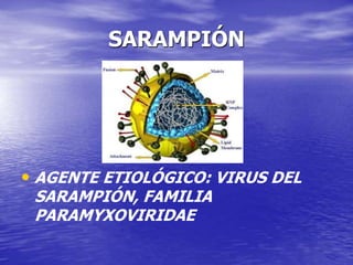 SARAMPIÓN
• AGENTE ETIOLÓGICO: VIRUS DEL
SARAMPIÓN, FAMILIA
PARAMYXOVIRIDAE
 