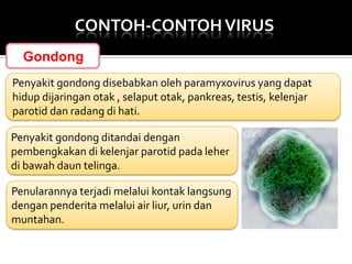 CONTOH-CONTOH VIRUS
Gondong
Penyakit gondong disebabkan oleh paramyxovirus yang dapat
hidup dijaringan otak , selaput otak, pankreas, testis, kelenjar
parotid dan radang di hati.
Penyakit gondong ditandai dengan
pembengkakan di kelenjar parotid pada leher
di bawah daun telinga.
Penularannya terjadi melalui kontak langsung
dengan penderita melalui air liur, urin dan
muntahan.

 