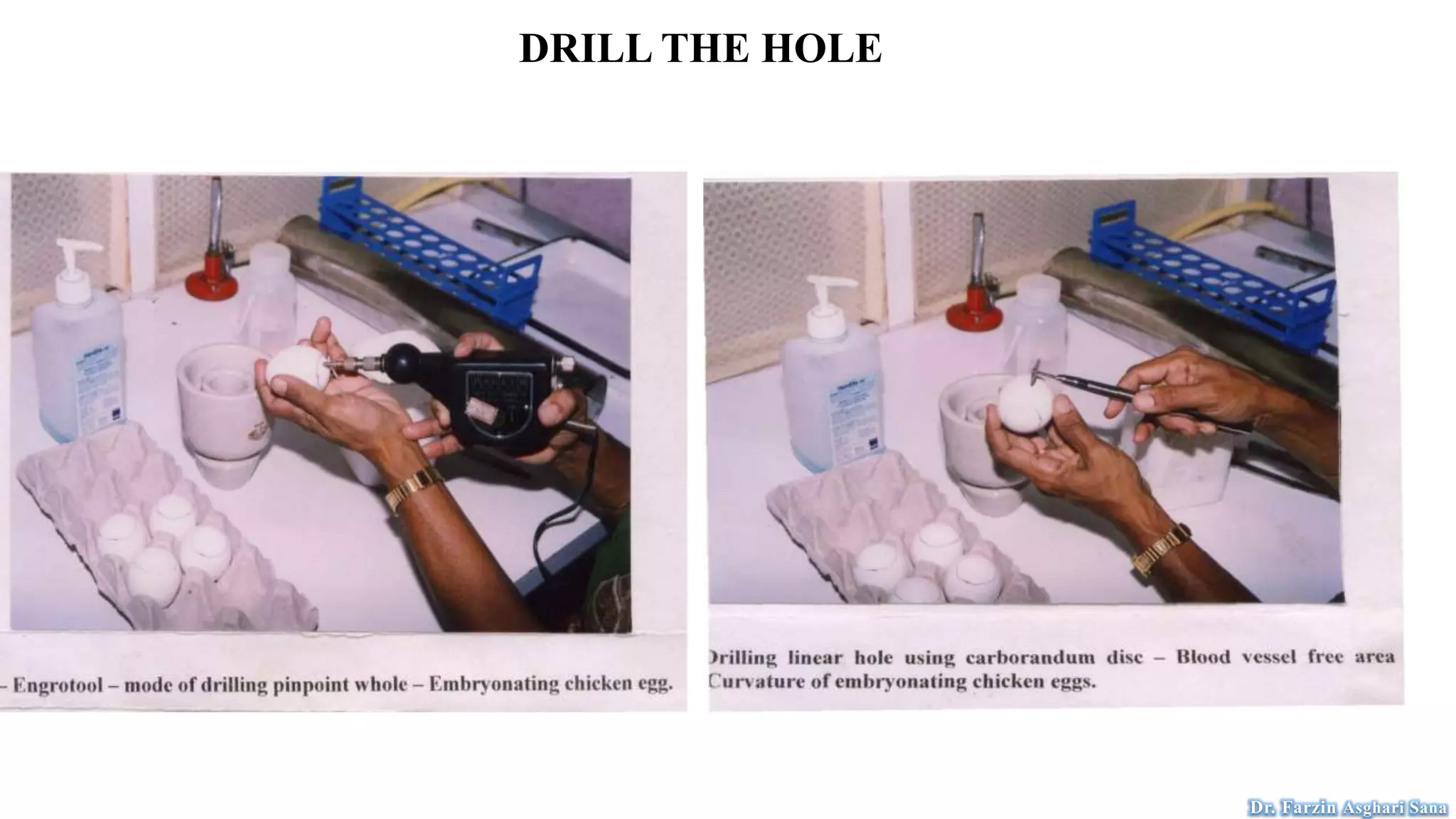 DRILL THE HOLE
Dr. Farzin Asghari Sana
 