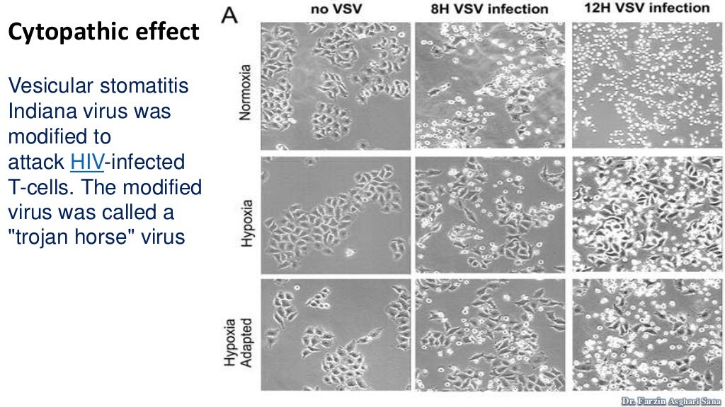 Virus culture and cytopathic effect