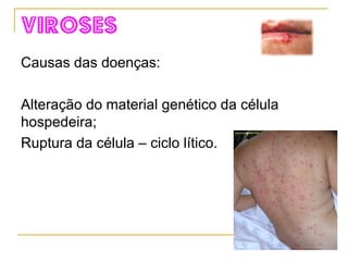 Síntese das cápsulas protéicas. 