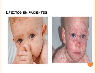 EFECTOS EN PACIENTES
 