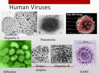 Human Viruses
Hepatitis A
Pneumonia
Influenza
Herpes
simplex
Hepatitis B
SARS
 