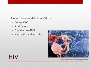 HIV
• Human Immunodeficiency Virus
• Causes AIDS
• A retrovirus
• Contains only RNA
• Infects white blood cells
https://en.wikipedia.org/wiki/HIV/AIDS#/media/File:HIV-budding-
Color.jpg
 