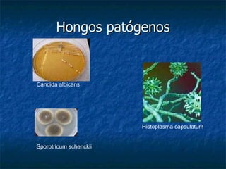 Hongos patógenos Candida albicans Sporotricum schenckii Histoplasma capsulatum 