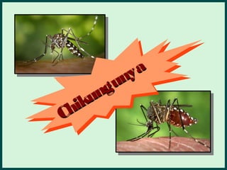   
Chikungunya
Chikungunya  
 
