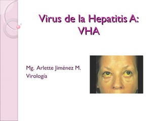 Virus de la Hepatitis A: VHA Mg.  Arlette Jiménez M. Virología 