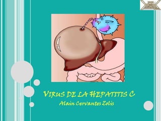Virus de la Hepatitis C Alain Cervantes Zolis 