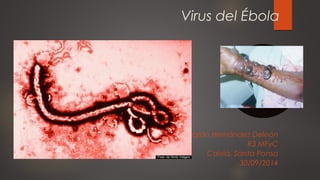 Virus del Ébola 
Eduardo Hernández Deleón 
R3 MFyC 
Calviá, Santa Ponsa 
30/09/2014 
 