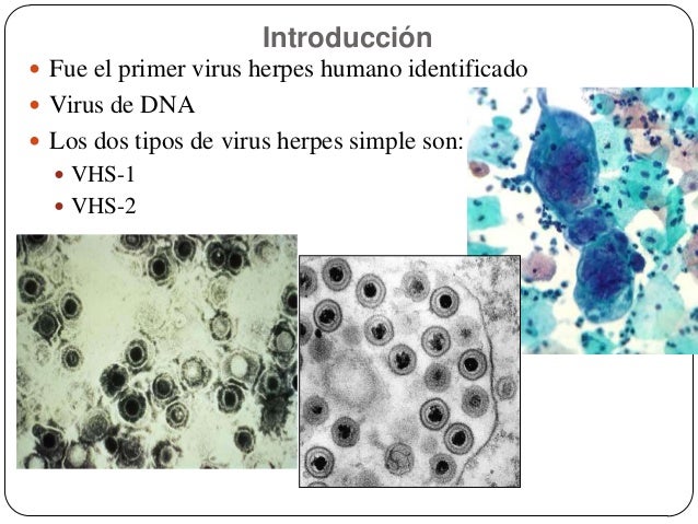 Herpes simples 1 2