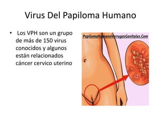 Virus Del Papiloma Humano
• Los VPH son un grupo
de más de 150 virus
conocidos y algunos
están relacionados
cáncer cervico uterino
 