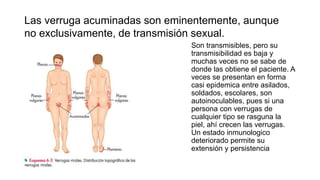 Las verruga acuminadas son eminentemente, aunque
no exclusivamente, de transmisión sexual.
Son transmisibles, pero su
transmisibilidad es baja y
muchas veces no se sabe de
donde las obtiene el paciente. A
veces se presentan en forma
casi epidemica entre asilados,
soldados, escolares, son
autoinoculables, pues si una
persona con verrugas de
cualquier tipo se rasguna la
piel, ahí crecen las verrugas.
Un estado inmunologico
deteriorado permite su
extensión y persistencia
 