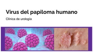 Virus del papiloma humano
Clínica de urología
 