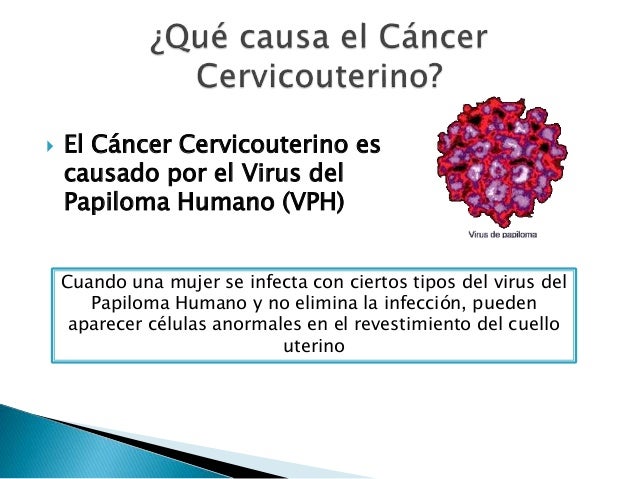 El Virus Del Papiloma Humano Vph Es Tan Comn Como Una | el virus papiloma humano vph es el virus del papiloma El Virus Del Papiloma Humano Vph Es Tan Comn Como Una | el virus papiloma humano vph es el virus del papiloma