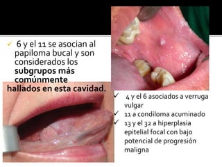  6 y el 11 se asocian al
papiloma bucal y son
considerados los
subgrupos más
comúnmente
hallados en esta cavidad.
 4 y el 6 asociados a verruga
vulgar
 11 a condiloma acuminado
 13 y el 32 a hiperplasia
epitelial focal con bajo
potencial de progresión
maligna
 