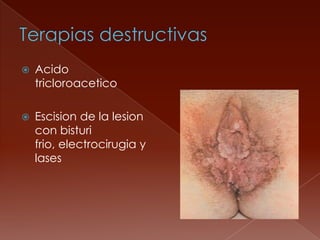    Acido
    tricloroacetico

   Escision de la lesion
    con bisturi
    frio, electrocirugia y
    lases
 