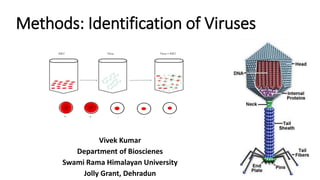 Methods: Identification of Viruses
Vivek Kumar
Department of Bioscienes
Swami Rama Himalayan University
Jolly Grant, Dehradun
 