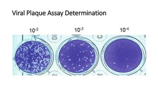 Viral Plaque Assay Determination
 