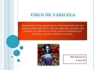 Enfermedad vírica aguda que se inicia generalmente con
síntomas generales leves, a los que sigue poco después una
  erupción que aparece en brotes y que se caracteriza por
          máculas, pápulas, vesículas y costras.




                                             Ilis Guevara
                                                  4-754-55
 