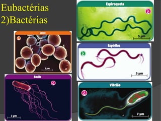 Eubactérias 
2)Bactérias 
 