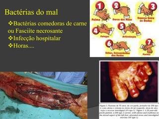 Bactérias do mal 
Bactérias comedoras de carne 
ou Fasciíte necrosante 
Infecção hospitalar 
Horas.... 
 