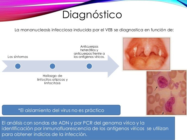 sintomas de infeccion por epstein barr