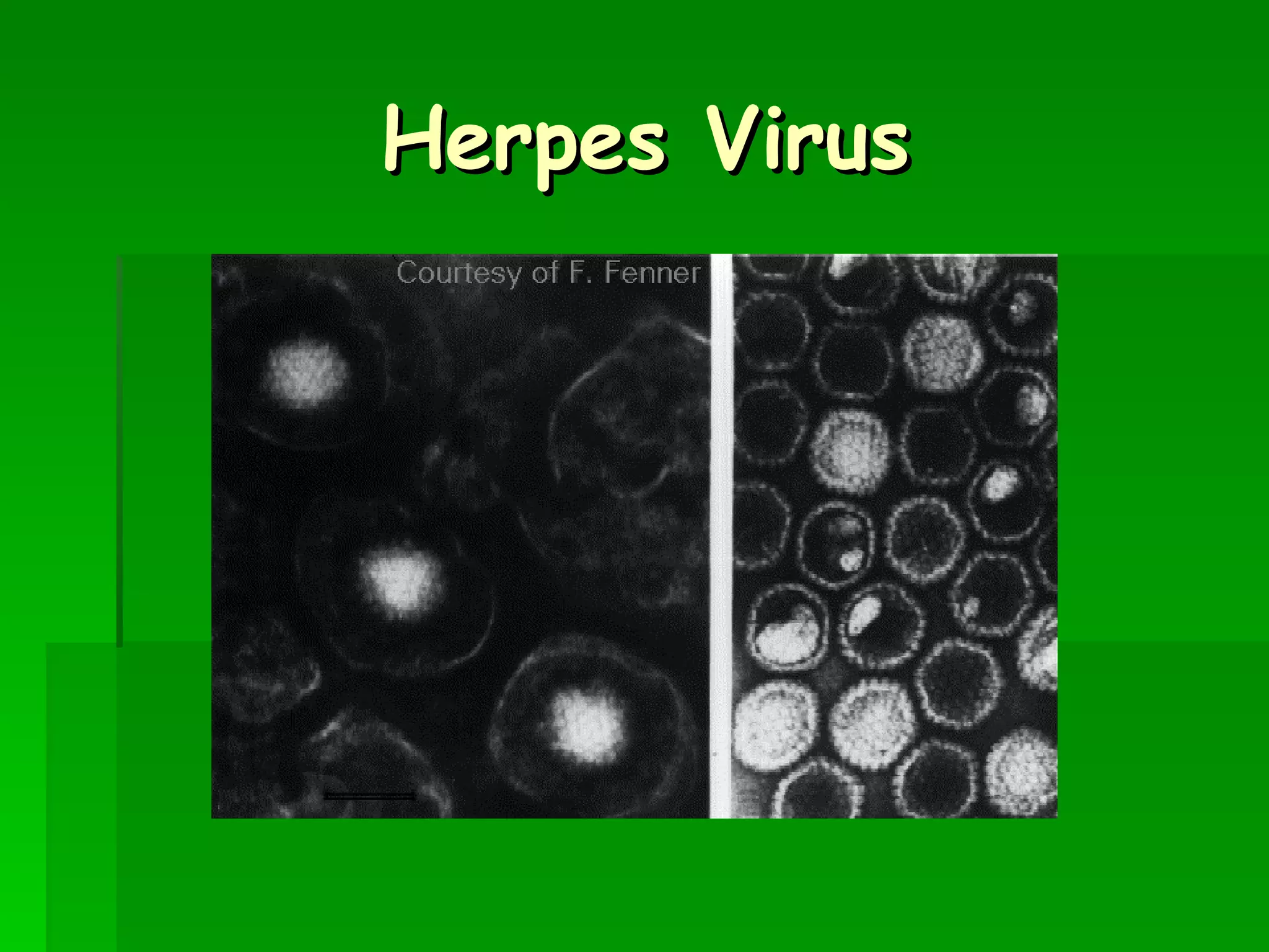 Herpes Virus 