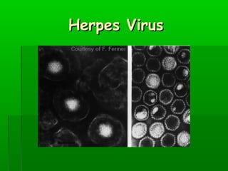 Herpes Virus

 