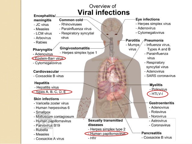 лимфоузлы эпштейн. мононуклеоз срок инкубации. мононуклеоз вирус эпштейн барра. вирус эпштейна-барр симптомы. инфекционный мононуклеоз эпштейна барра что это.