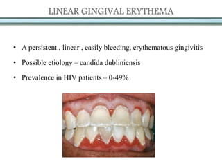 LINEAR GINGIVAL ERYTHEMA
• A persistent , linear , easily bleeding, erythematous gingivitis
• Possible etiology – candida dubliniensis
• Prevalence in HIV patients – 0-49%
 