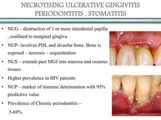 NECROTISING ULCERATIVE GINGIVITIS
PERIODONTITIS , STOMATITIS
• NUG – destruction of 1 or more interdental papilla
, confined to marginal gingiva
• NUP- involves PDL and alveolar bone. Bone is
exposed – necrosis – sequestration
• NUS – extends past MGJ into mucosa and osseous
tissues
• Higher prevalence in HIV patients
• NUP – marker of immune deterioration with 95%
predictive value
• Prevalence of Chronic periodontitis –
5-69%
 