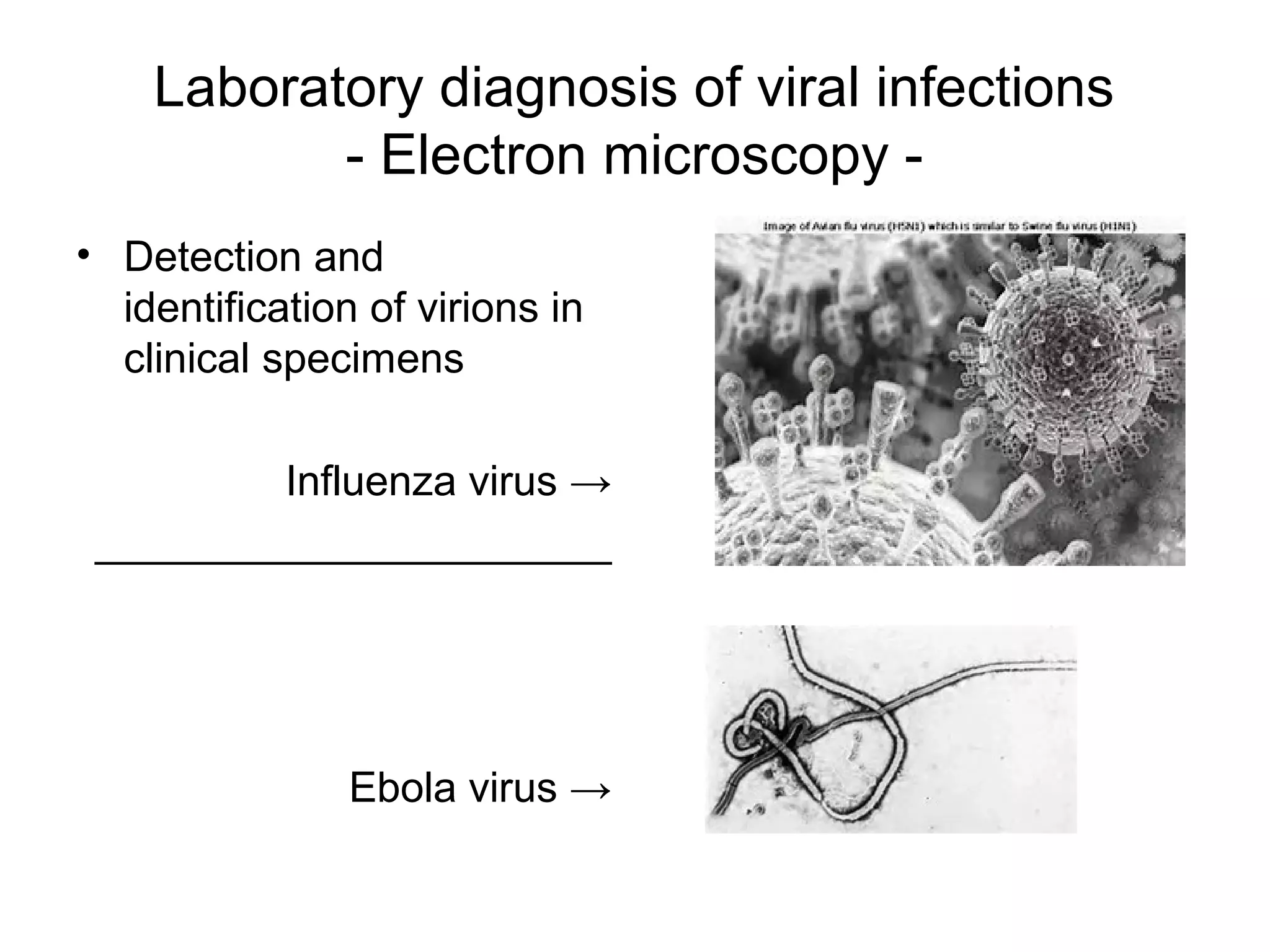 Laboratory diagnosis of viral infections
- Electron microscopy -
• Detection and
identification of virions in
clinical specimens
Influenza virus →
______________________
Ebola virus →
 