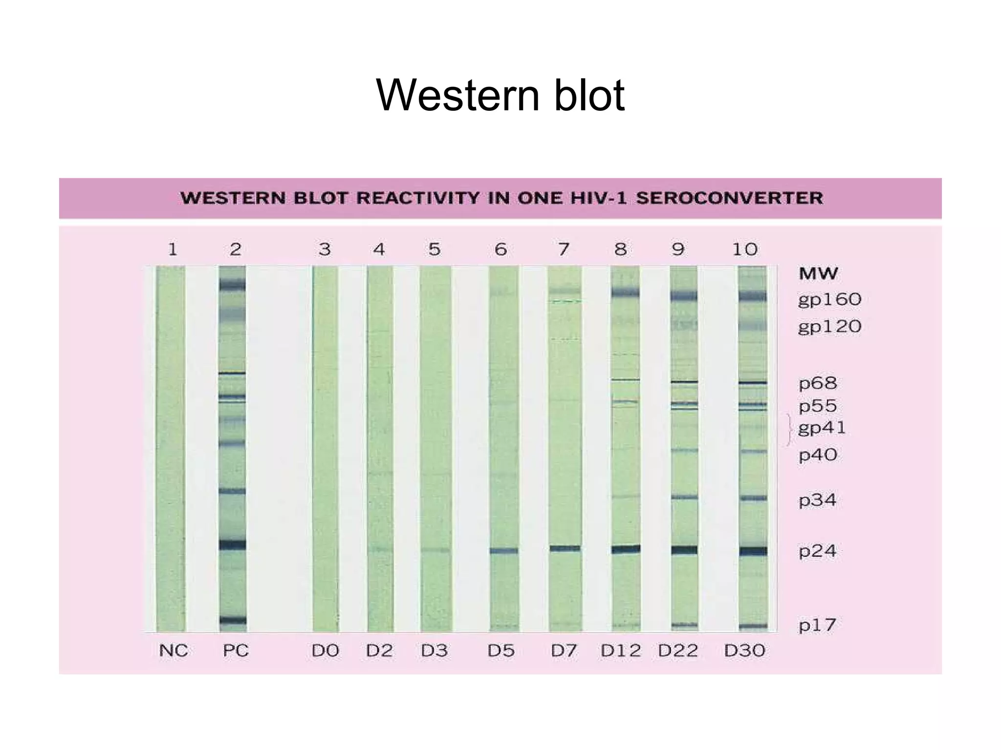 Western blot
 