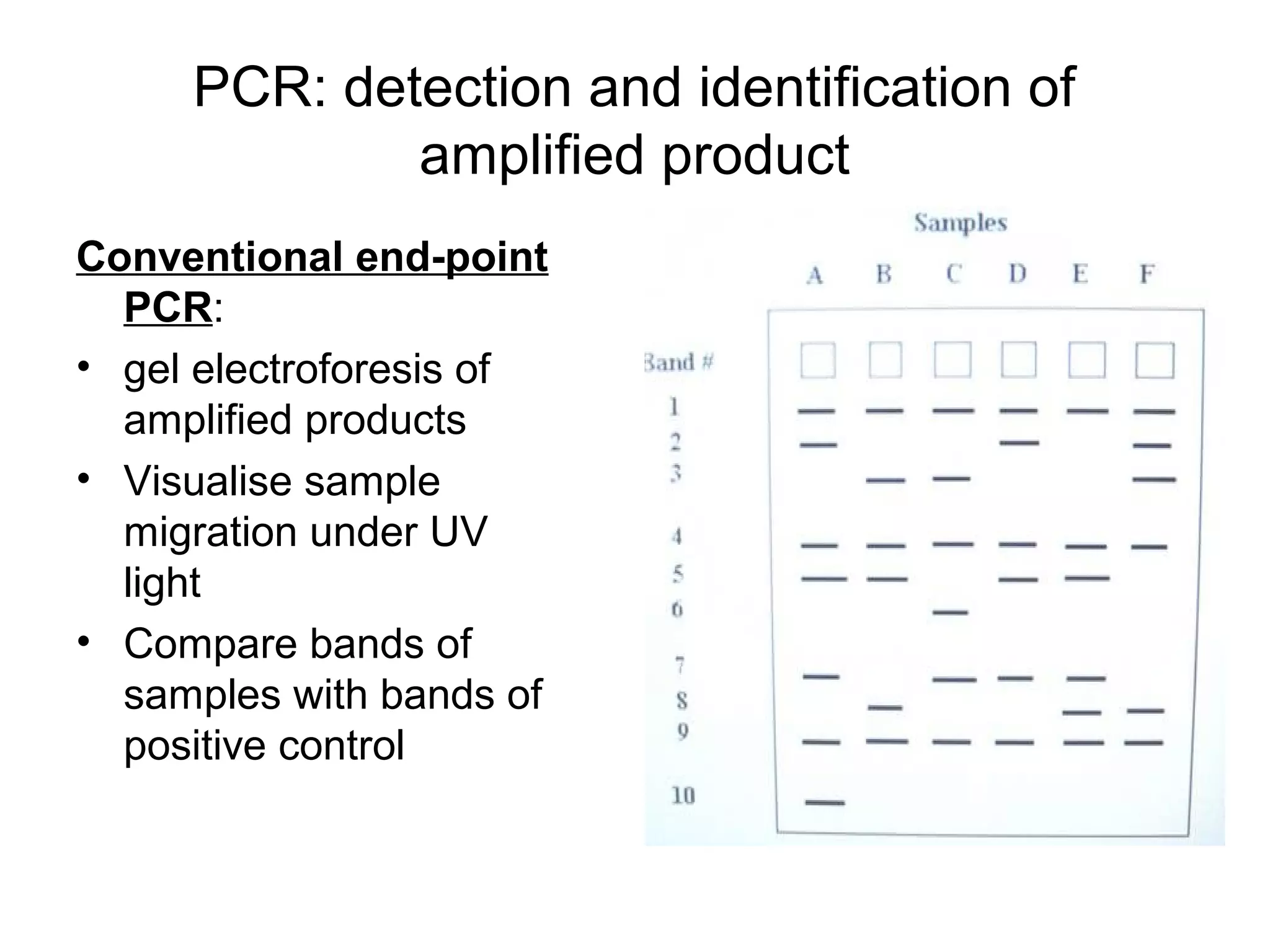 PCR: detection and identification of
amplified product
Conventional end-point
PCR:
• gel electroforesis of
amplified products
• Visualise sample
migration under UV
light
• Compare bands of
samples with bands of
positive control
 