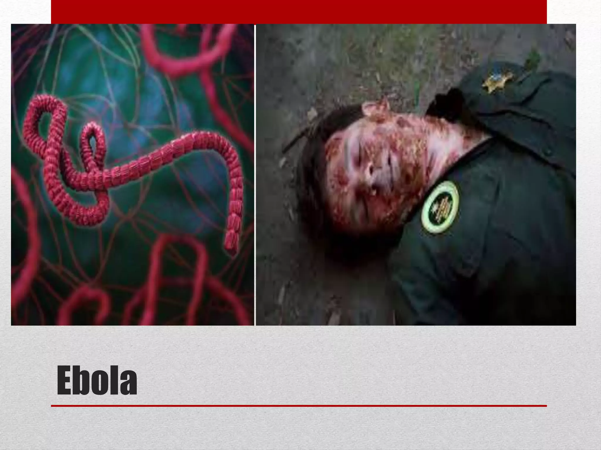 Ebola
 