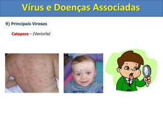Os linfócitos CD4 são responsáveis por “alertar” o organismo quando há a invasão de agentes estranhos (antígenos).