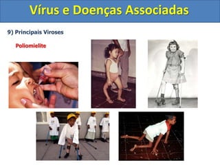 Vírus e Doenças Associadas9) Principais VirosesSarampo	Agente Etiológico: Vírus do sarampo	Forma de transmissão: Vias aéreas (oral e respiratória); contato pessoa-pessoa; contato com objetos contaminados com o vírus.	Sintomas: Febre alta		         Tosse seca		         Aparecimento de manchas vermelhas pelo corpo	Tratamento: Não possui. Geralmente o sistema imune consegue eliminar o vírus.	Profilaxia: Vacinação na infância (tríplice viral)