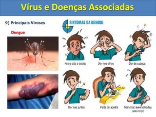 Vírus e Doenças Associadas9) Principais VirosesCatapora – (Varicela)	Agente Etiológico: Varicela zoster	Forma de transmissão: Vias aéreas (oral e respiratória); contato pessoa-pessoa; contato com objetos contaminados com o vírus.	Sintomas: Lesões na pele que causam ardor e coceira		        Em crianças: catapora ou varicela		        Em aduto: cobreiro	Tratamento: Não possui. Geralmente o sistema imune consegue eliminar o vírus.	Profilaxia: Vacinação na infância		        Evitar contato com pessoas contaminadas