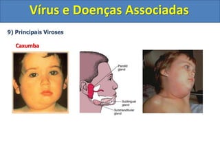 Vírus e Doenças Associadas9) Principais VirosesFebre AmarelaI) Agente EtiológicoVírus da Febre Amarela (Flavivírus – Vírus de RNA)	II) Agente Vetor Aedesaegypti(Ambiente Urbano) Haemagogos (Ambiente Silvestre)III) Hospedeiros VertebradosMacacos e Roedores (Ambiente Silvestre)Homem (Quando este invade o ambiente silvestre sem vacinação prévia)Obs: A febre amarela urbana não é mais relatada no Brasil desde 1960.