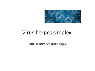 Virus herpes simplex.
Prof. Moisés Arriagada Rojas.
 