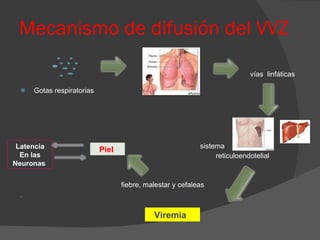 Mecanismo de difusión del VVZ vías  linfáticas  Gotas respiratorias   sistema  reticuloendotelial fiebre, malestar y cefaleas Viremia   Piel   Latencia En las Neuronas  