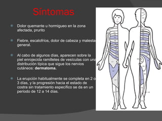 Síntomas   Dolor quemante u hormigueo en la zona afectada, prurito  Fiebre, escalofríos, dolor de cabeza y malestar general.  Al cabo de algunos días, aparecen sobre la piel enrojecida ramilletes de vesículas con una distribución típica que sigue los nervios cutáneos:  dermatoma. La erupción habitualmente se completa en 2 o 3 días, y la progresión hacia el estado de costra sin tratamiento específico se da en un período de 12 a 14 días. 