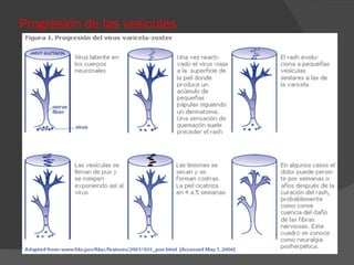 Progresión de las vesículas  