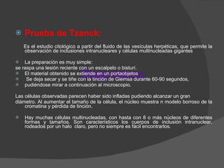Diagnóstico Prueba de Tzanck: Es el estudio citológico a partir del fluido de las vesículas herpéticas, que permite la observación de inclusiones intranucleares y células multinucleadas gigantes  La preparación es muy simple:  se raspa una lesión reciente con un escalpelo o bisturí.  El material obtenido se extiende en un portaobjetos Se deja secar y se tiñe con la tinción de Giemsa durante 60-90 segundos, pudiéndose mirar a continuación al microscopio. Las células observadas parecen haber sido infladas pudiendo alcanzar un gran diámetro. Al aumentar el tamaño de la célula, el núcleo muestra n modelo borroso de la cromatina y pérdida de tinción. Hay muchas células multinucleadas, con hasta con 8 o más núcleos de diferentes formas y tamaños. Son característicos los cuerpos de inclusión intranuclear, rodeados por un halo  claro, pero no siempre es fácil encontrarlos. 