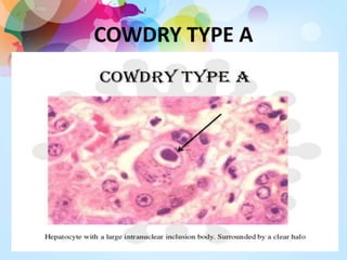 COWDRY TYPE A
 